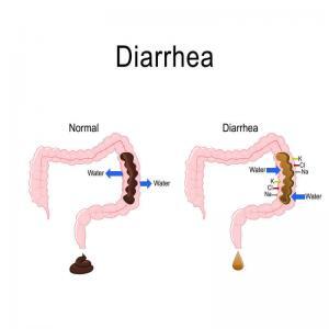 nocturnal diarrhea causes