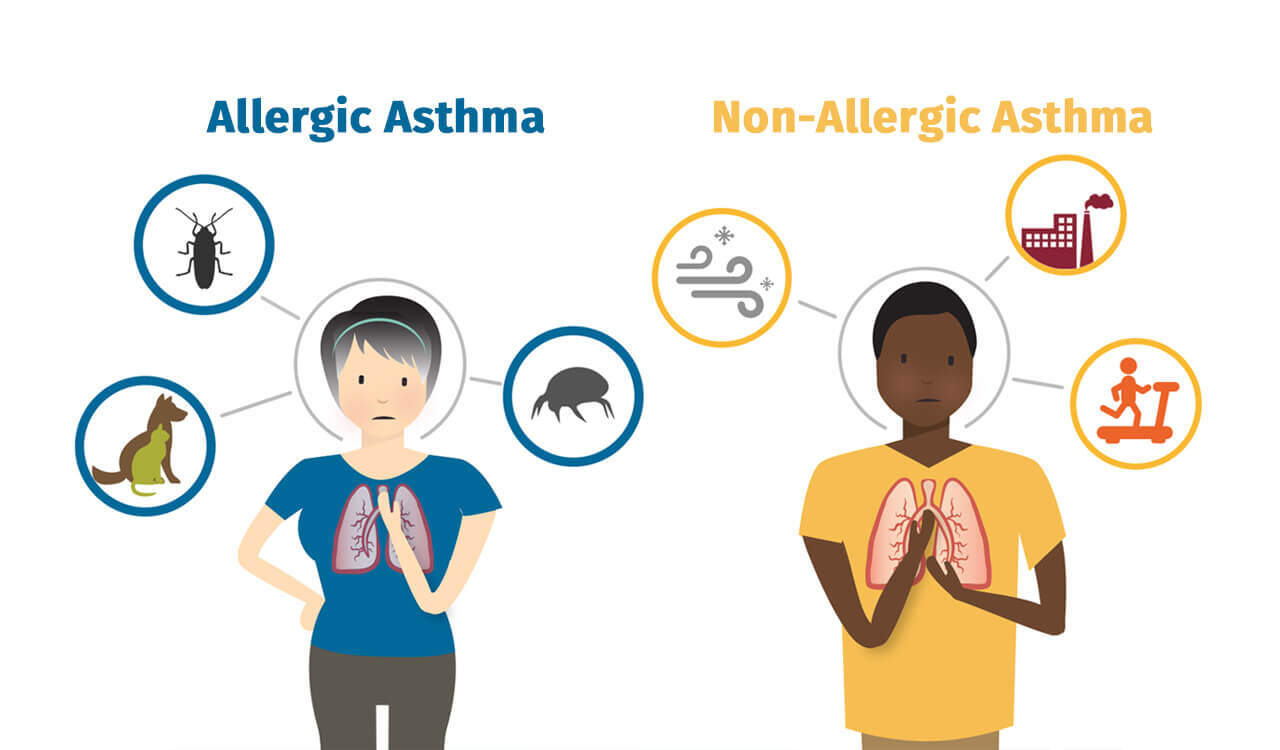 Pathophysiology Asthma Medicalbrandnames