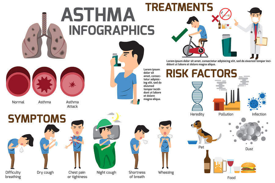 using-radiofrequency-to-treat-severe-asthma-bronchial-thermoplasty